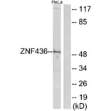 Western Blot - Anti-ZNF436 Antibody (C11660) - Antibodies.com
