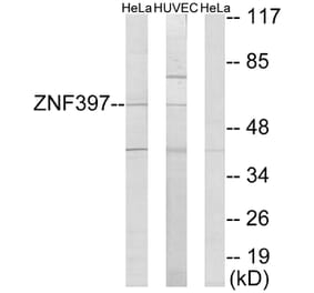 Western Blot - Anti-ZNF397 Antibody (C11371) - Antibodies.com