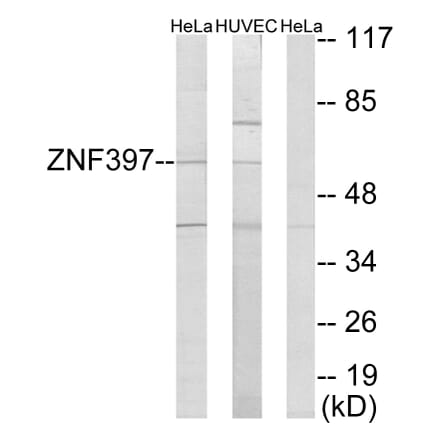 Western Blot - Anti-ZNF397 Antibody (C11371) - Antibodies.com