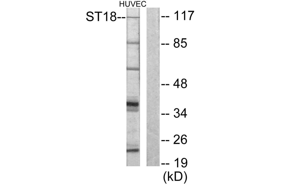 Western Blot - Anti-ZNF387 Antibody (C10130) - Antibodies.com