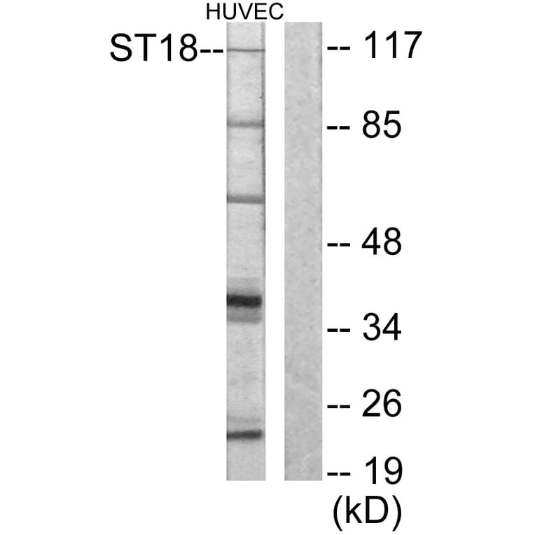 Western Blot - Anti-ZNF387 Antibody (C10130) - Antibodies.com