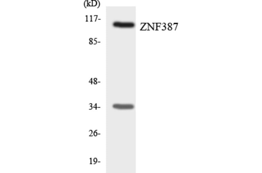 Western Blot - Anti-ZNF387 Antibody (R12-3699) - Antibodies.com