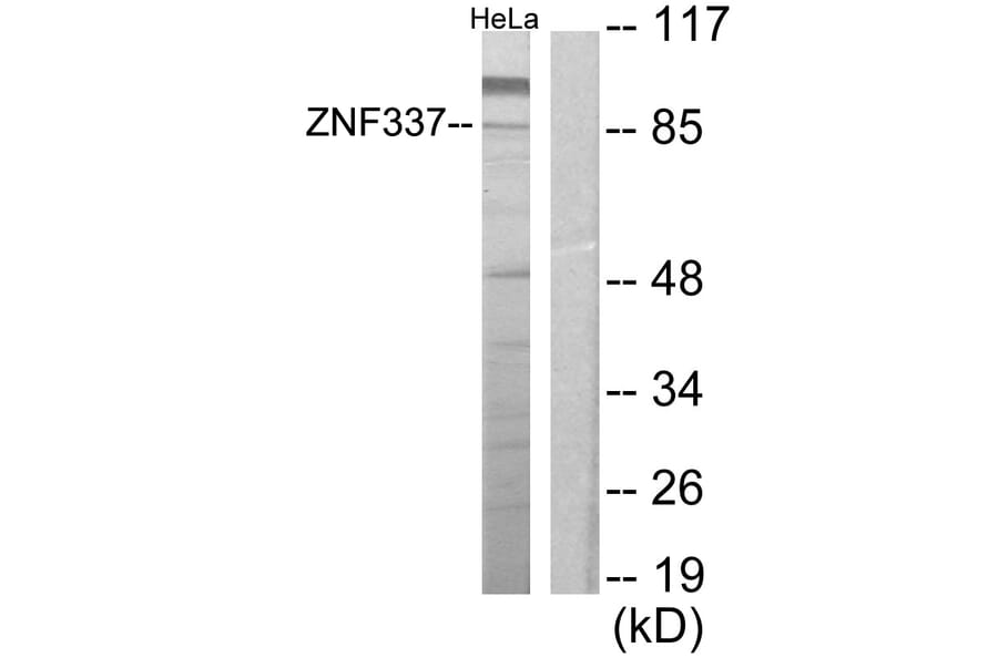Western Blot - Anti-ZNF337 Antibody (C11951) - Antibodies.com