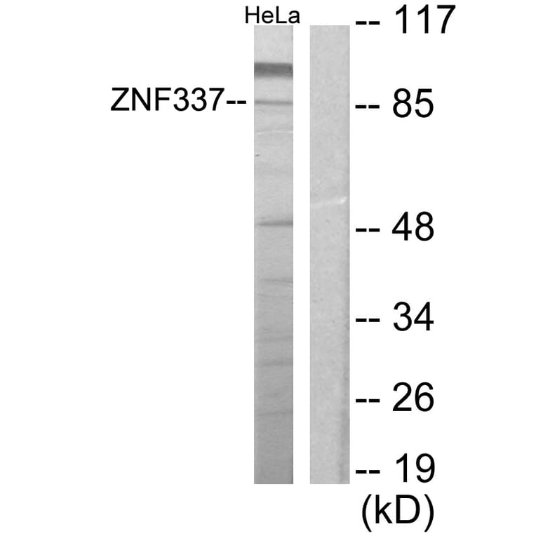 Western Blot - Anti-ZNF337 Antibody (C11951) - Antibodies.com