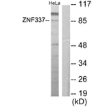 Western Blot - Anti-ZNF337 Antibody (C11951) - Antibodies.com