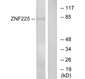 Western Blot - Anti-ZNF225 Antibody (C11865) - Antibodies.com