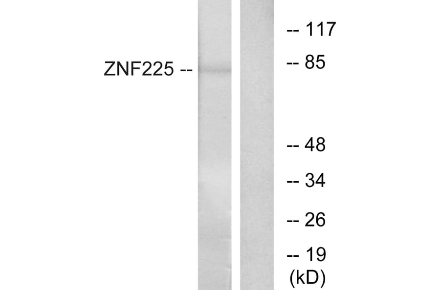 Western Blot - Anti-ZNF225 Antibody (C11865) - Antibodies.com