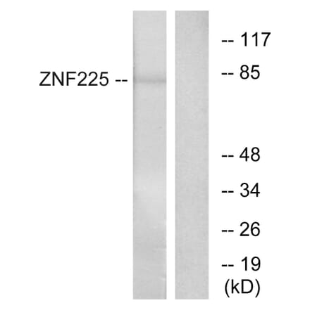 Western Blot - Anti-ZNF225 Antibody (C11865) - Antibodies.com