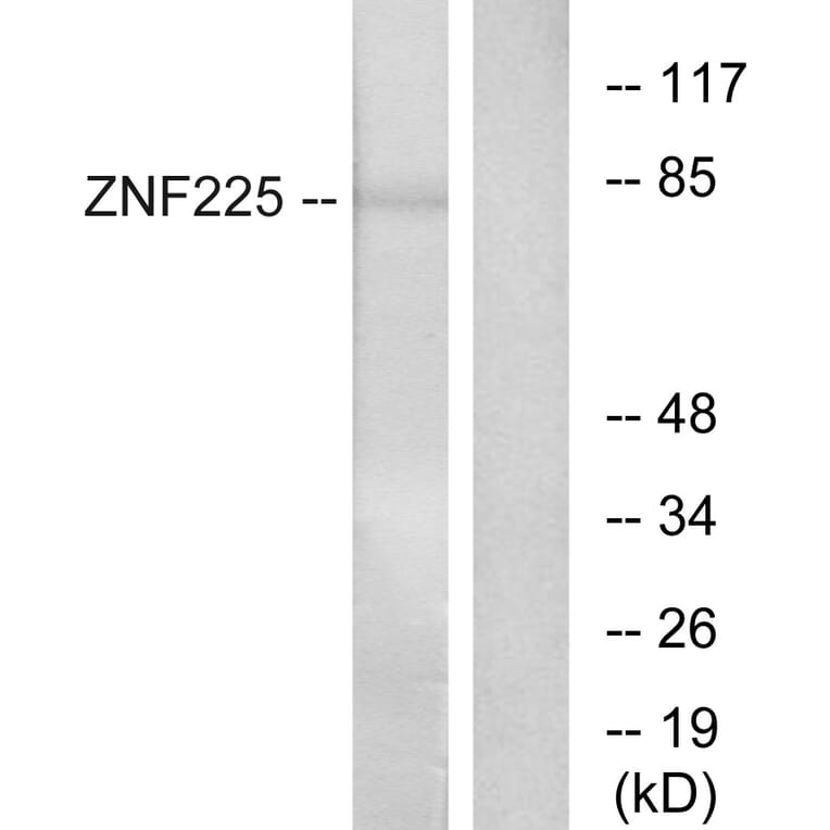 Western Blot - Anti-ZNF225 Antibody (C11865) - Antibodies.com