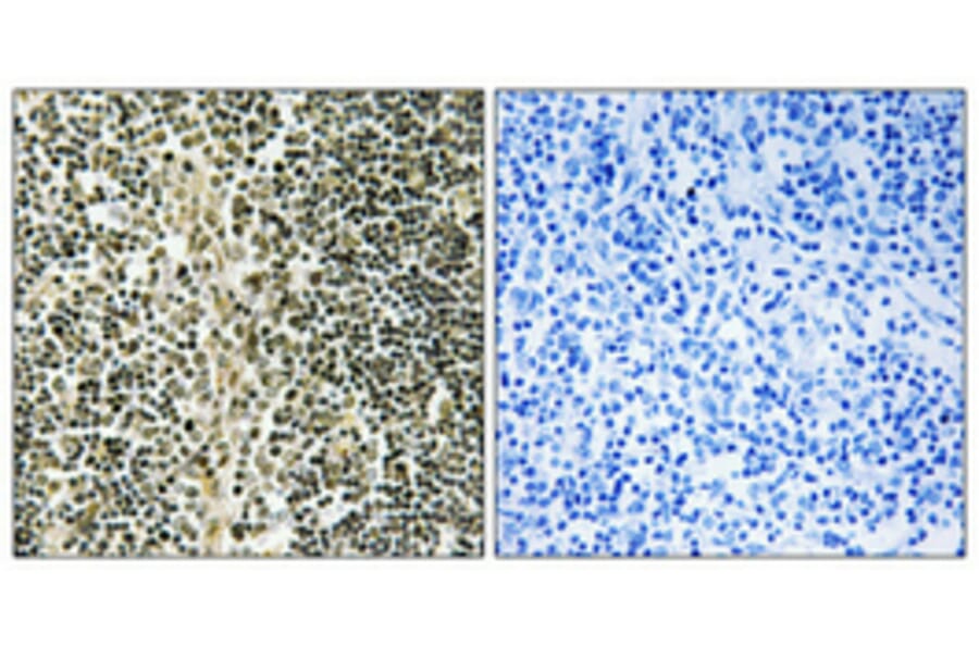 Immunohistochemistry - Anti-ZNF225 Antibody (C11865) - Antibodies.com