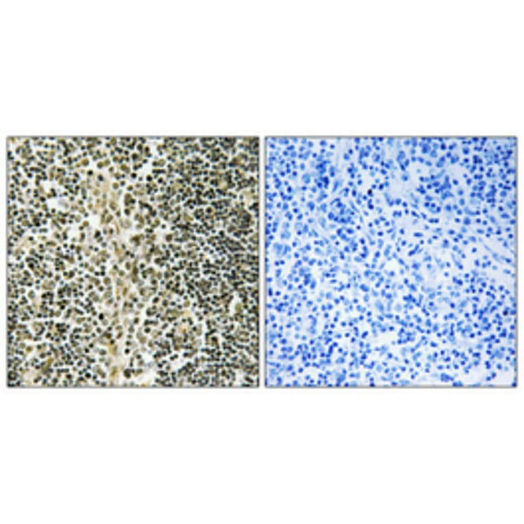 Immunohistochemistry - Anti-ZNF225 Antibody (C11865) - Antibodies.com