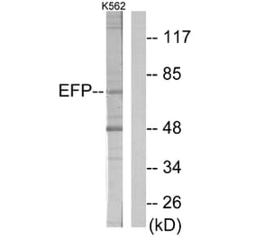 Western Blot - Anti-ZNF147 Antibody (C11026) - Antibodies.com