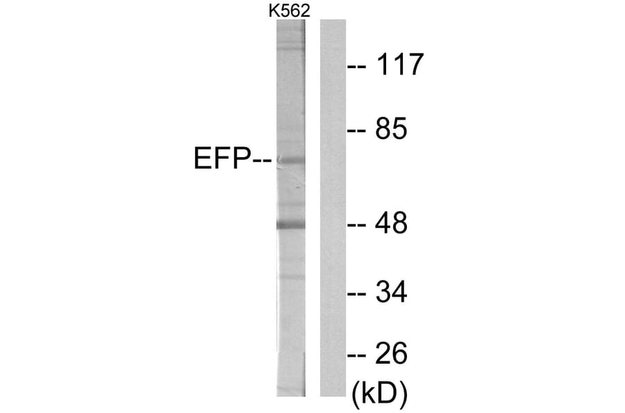Western Blot - Anti-ZNF147 Antibody (C11026) - Antibodies.com