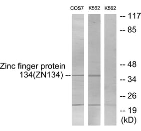 Western Blot - Anti-ZNF134 Antibody (C10705) - Antibodies.com