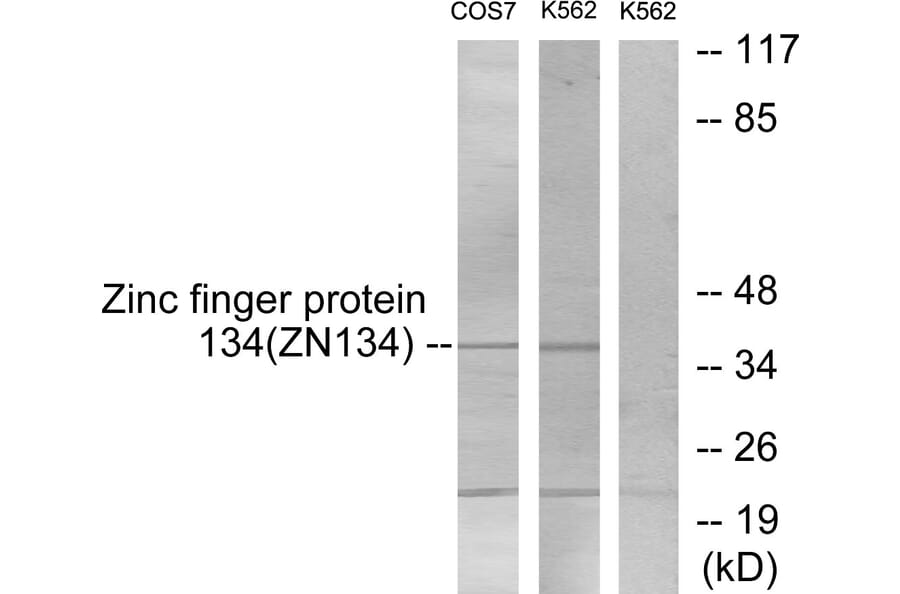 Western Blot - Anti-ZNF134 Antibody (C10705) - Antibodies.com