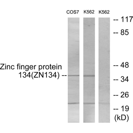 Western Blot - Anti-ZNF134 Antibody (C10705) - Antibodies.com