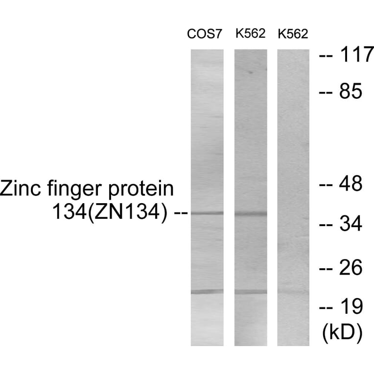 Western Blot - Anti-ZNF134 Antibody (C10705) - Antibodies.com