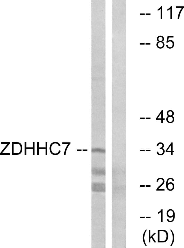 Western blot analysis of lysates from HUVEC cells using Anti-ZDHHC7 Antibody. The right hand lane represents a negative control, where the antibody is blocked by the immunising peptide.