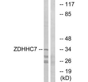 Western Blot - Anti-ZDHHC7 Antibody (C17599) - Antibodies.com