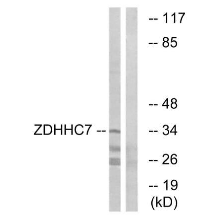 Western Blot - Anti-ZDHHC7 Antibody (C17599) - Antibodies.com