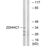 Western Blot - Anti-ZDHHC7 Antibody (C17599) - Antibodies.com