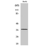 Western Blot - Anti-ZDHHC7 Antibody (C17599) - Antibodies.com