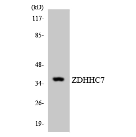 Western Blot - Anti-ZDHHC7 Antibody (R12-3691) - Antibodies.com