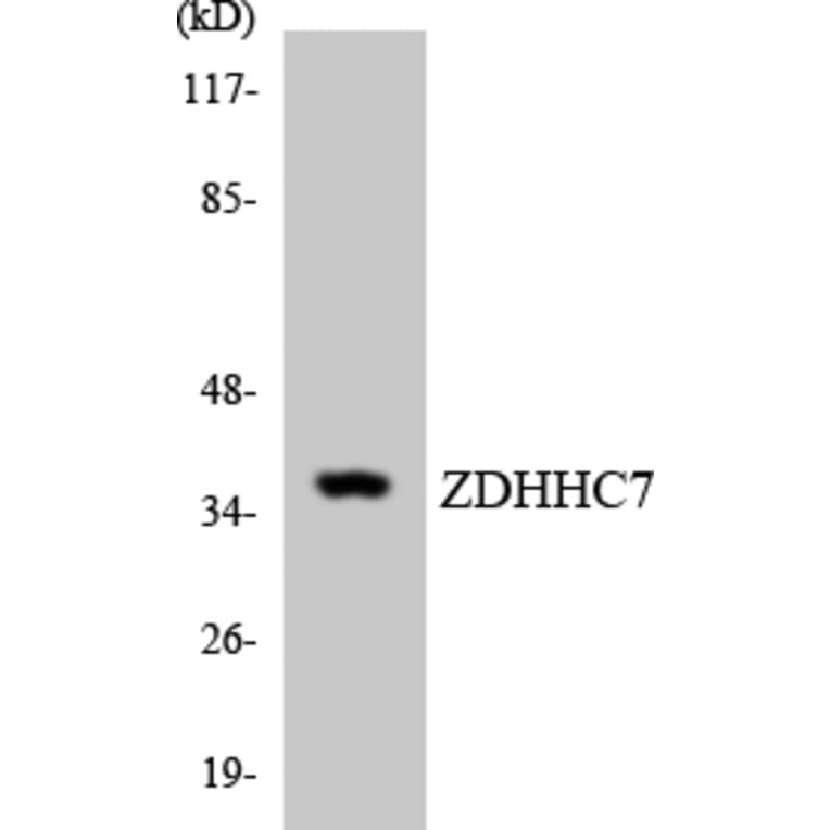 Western Blot - Anti-ZDHHC7 Antibody (R12-3691) - Antibodies.com