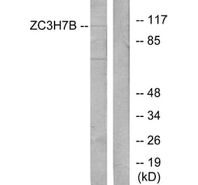 Western Blot - Anti-ZC3H7B Antibody (C11837) - Antibodies.com