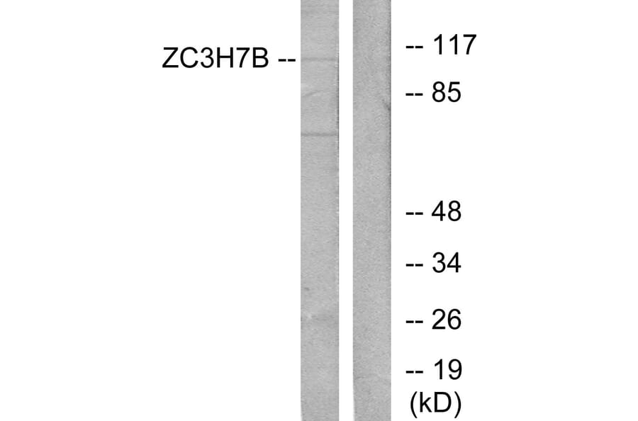 Western Blot - Anti-ZC3H7B Antibody (C11837) - Antibodies.com