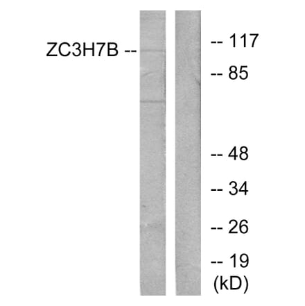 Western Blot - Anti-ZC3H7B Antibody (C11837) - Antibodies.com