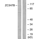 Western Blot - Anti-ZC3H7B Antibody (C11837) - Antibodies.com