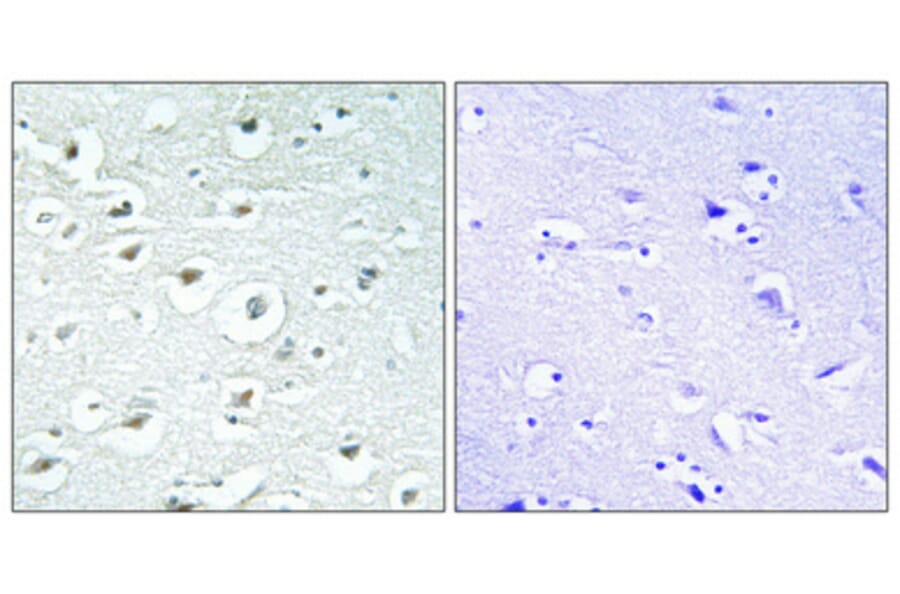 Immunohistochemistry - Anti-ZC3H7B Antibody (C11837) - Antibodies.com