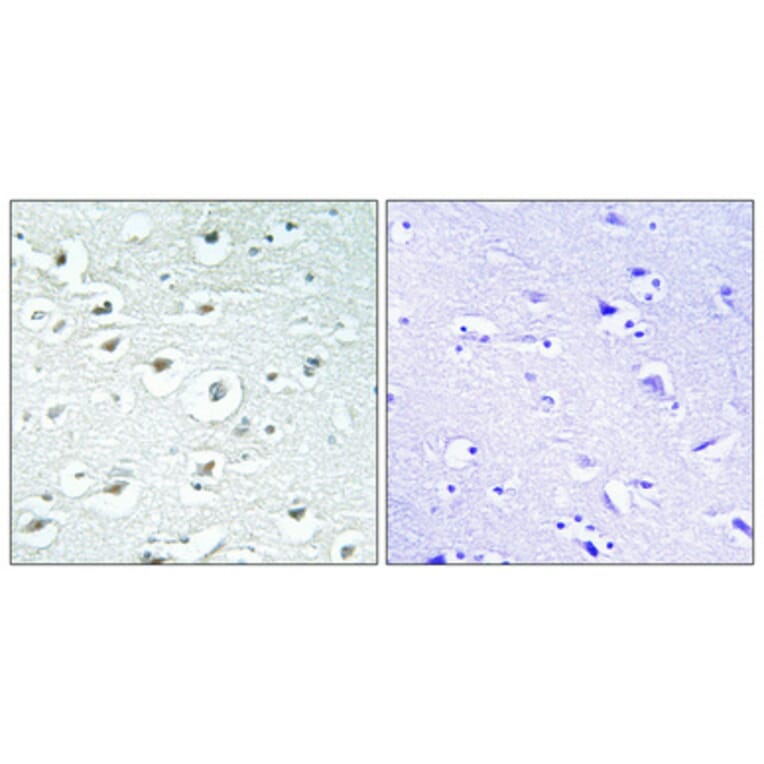 Immunohistochemistry - Anti-ZC3H7B Antibody (C11837) - Antibodies.com
