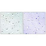 Immunohistochemistry - Anti-ZC3H7B Antibody (C11837) - Antibodies.com