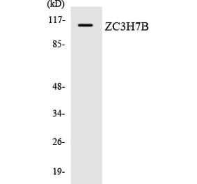 Western Blot - Anti-ZC3H7B Antibody (R12-3688) - Antibodies.com