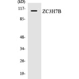 Western Blot - Anti-ZC3H7B Antibody (R12-3688) - Antibodies.com