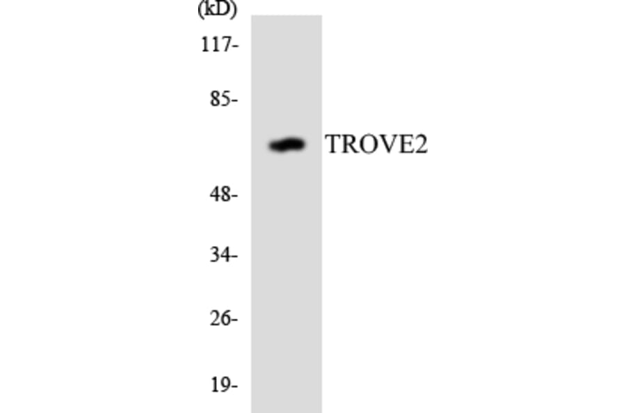Western Blot - Anti-TROVE2 Antibody (R12-3652) - Antibodies.com