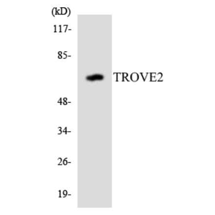 Western Blot - Anti-TROVE2 Antibody (R12-3652) - Antibodies.com