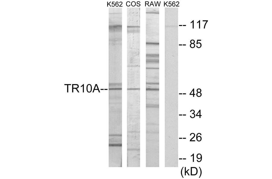 Western Blot - Anti-TR10A Antibody (C10014) - Antibodies.com