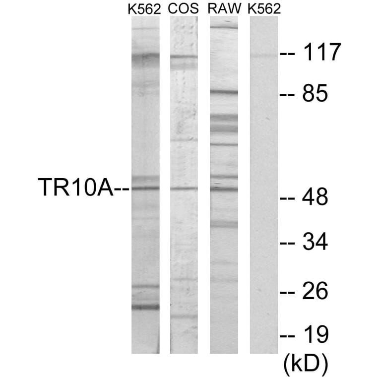 Western Blot - Anti-TR10A Antibody (C10014) - Antibodies.com