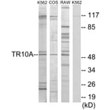 Western Blot - Anti-TR10A Antibody (C10014) - Antibodies.com