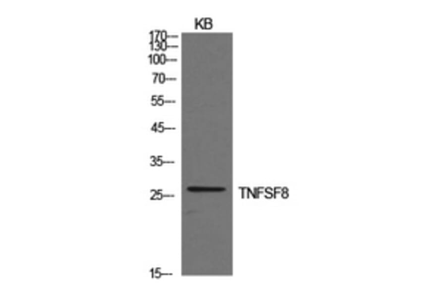 Western Blot - Anti-TNFSF8 Antibody (C30500) - Antibodies.com