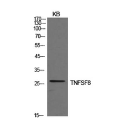 Western Blot - Anti-TNFSF8 Antibody (C30500) - Antibodies.com