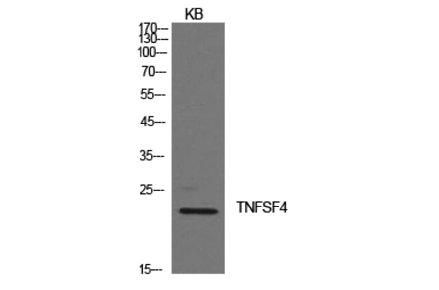 Western Blot - Anti-TNFSF4 Antibody (C30490) - Antibodies.com