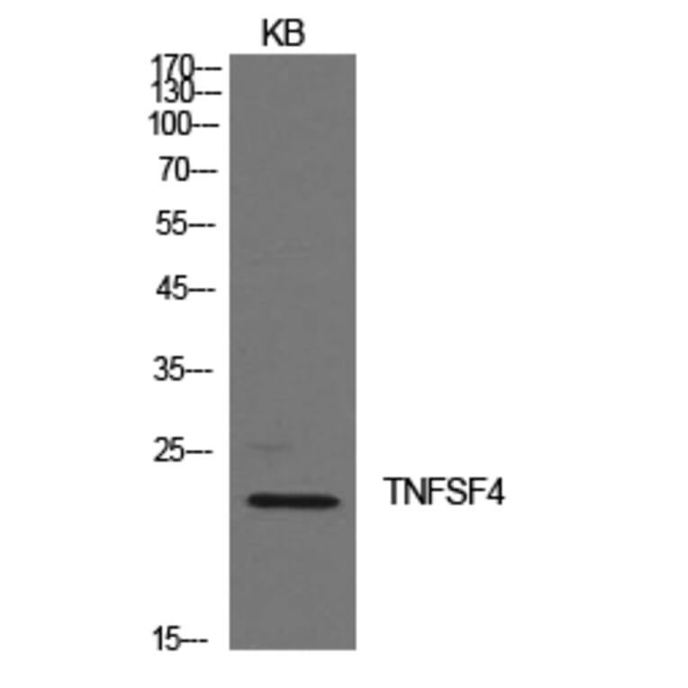 Western Blot - Anti-TNFSF4 Antibody (C30490) - Antibodies.com