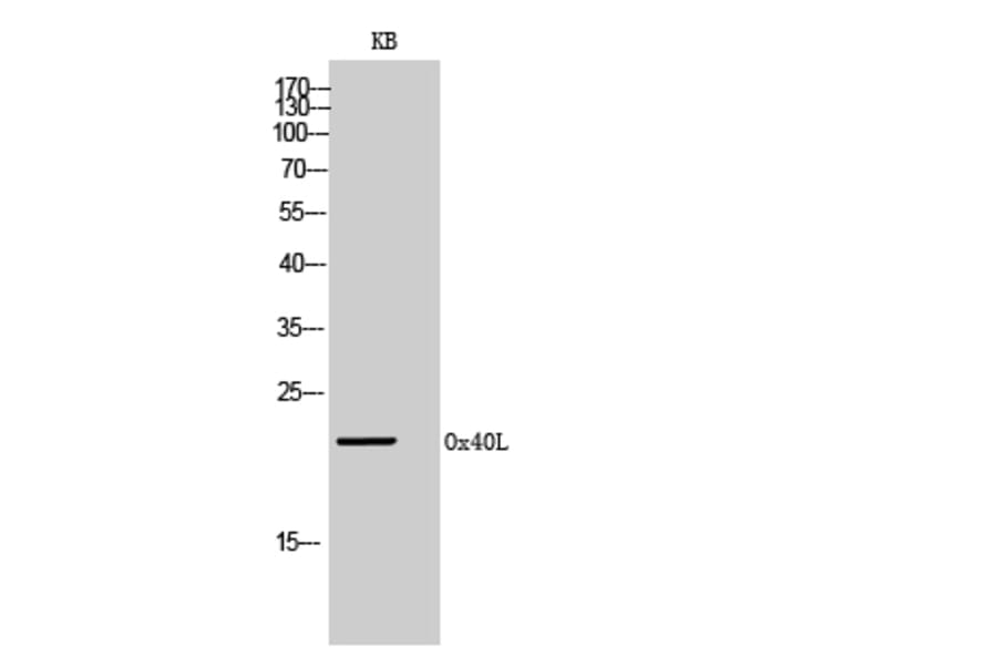 Western Blot - Anti-TNFSF4 Antibody (C30490) - Antibodies.com