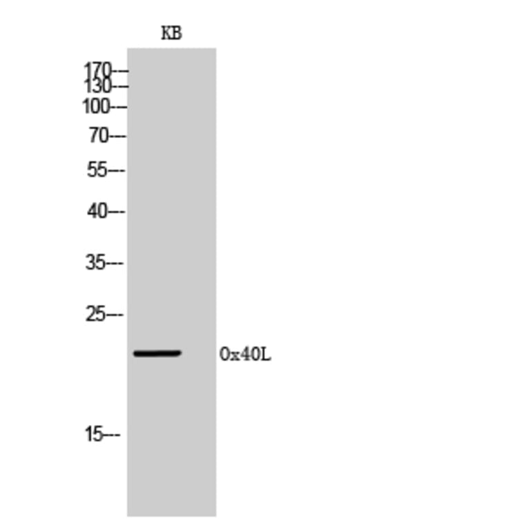 Western Blot - Anti-TNFSF4 Antibody (C30490) - Antibodies.com