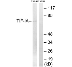 Western Blot - Anti-TIF-IA Antibody (B8433) - Antibodies.com