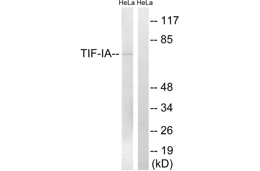 Western Blot - Anti-TIF-IA Antibody (B8433) - Antibodies.com